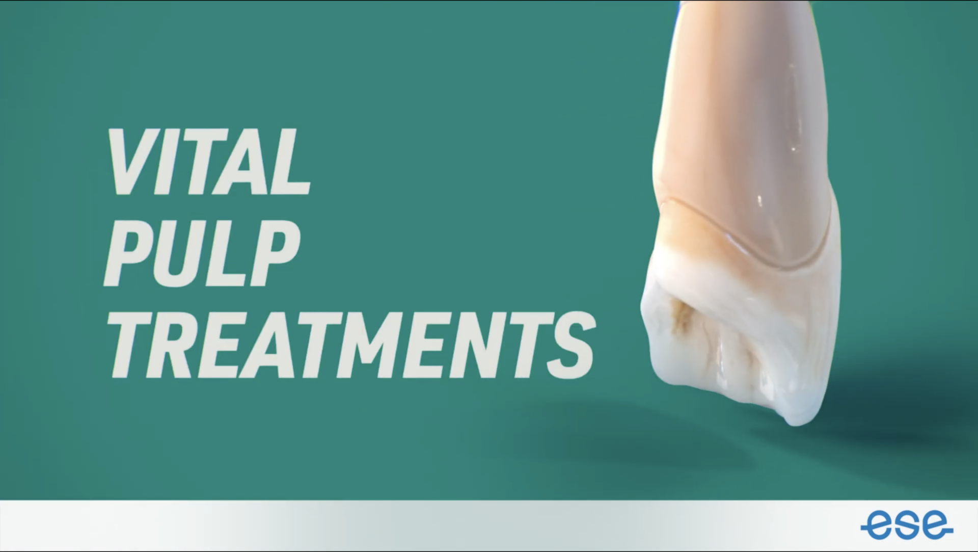 ESE Video 2 – Vital pulp treatment